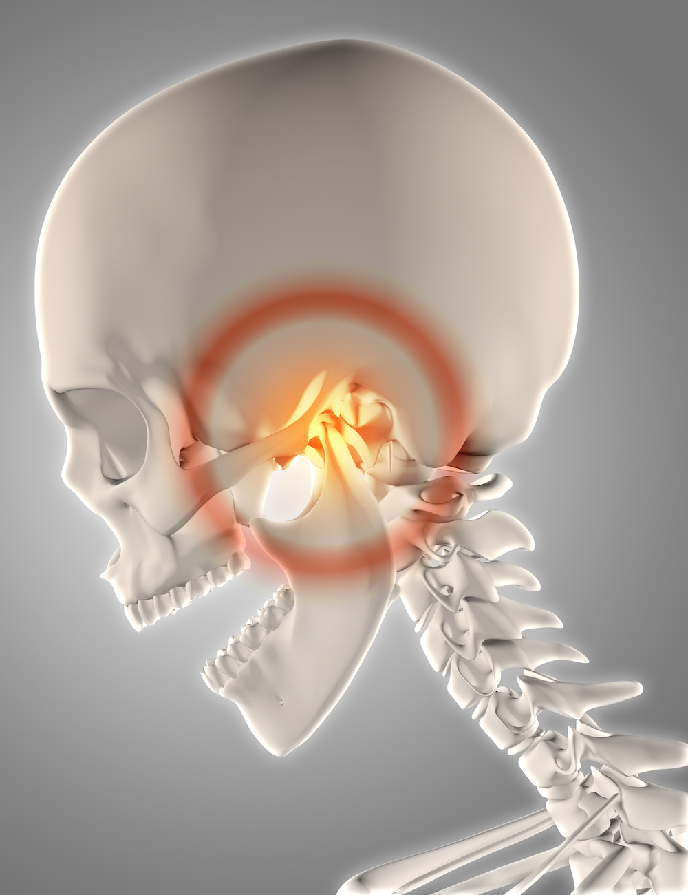 3D render of a skeleton with jawbone highlighted to show pain