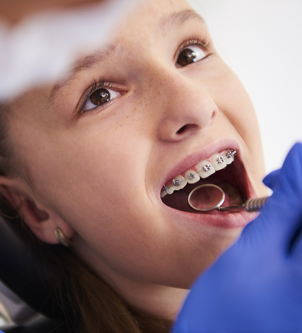 Girl with braces during a routine, dental examination