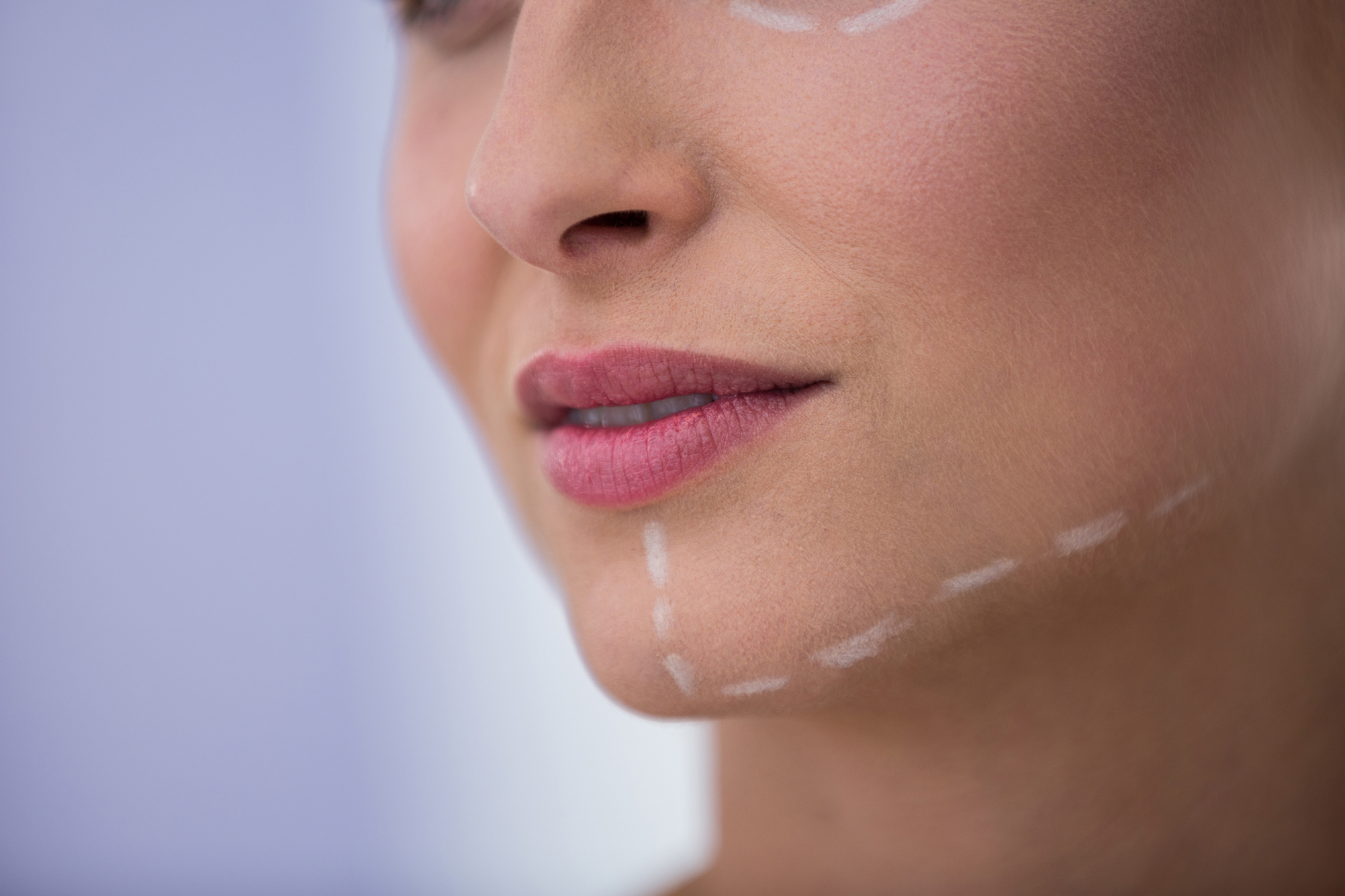 Close-up of Woman with marks drawn for cosmetic treatment on her jaw