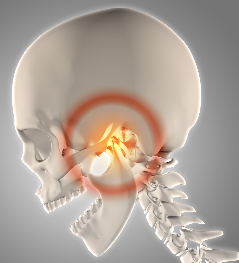 3D render of a skeleton with jawbone highlighted to show pain