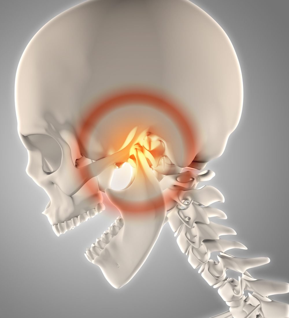 3D render of a skeleton with jawbone highlighted to show pain
