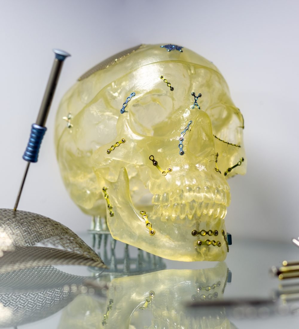 Tools and equipment for orthopedic and surgical reconstruction of the skull