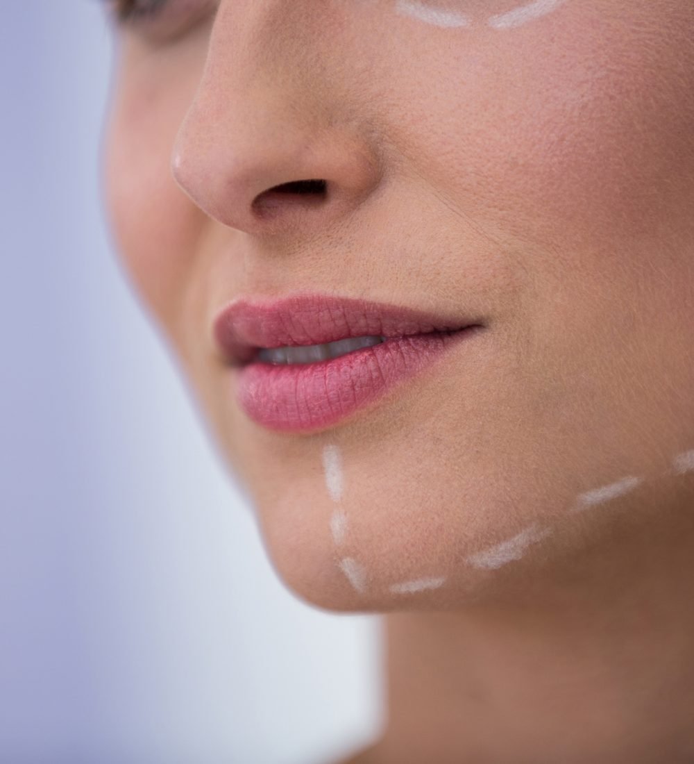 Close-up of Woman with marks drawn for cosmetic treatment on her jaw
